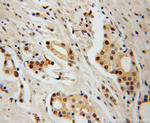 HDAC2 Antibody in Immunohistochemistry (Paraffin) (IHC (P))