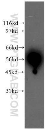 HDAC2 Antibody in Western Blot (WB)