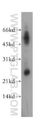 DUSP19 Antibody in Western Blot (WB)