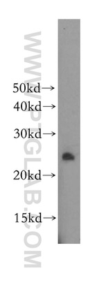 DUSP19 Antibody in Western Blot (WB)