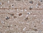 NCALD Antibody in Immunohistochemistry (Paraffin) (IHC (P))