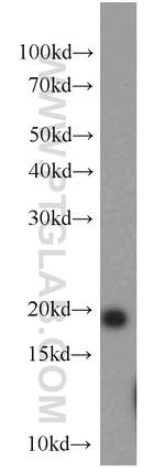 NCALD Antibody in Western Blot (WB)