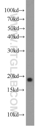 NCALD Antibody in Western Blot (WB)