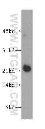 NCALD Antibody in Western Blot (WB)