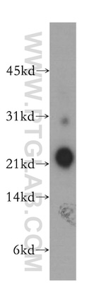 NCALD Antibody in Western Blot (WB)