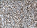 SKAP2 Antibody in Immunohistochemistry (Paraffin) (IHC (P))