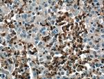 SKAP2 Antibody in Immunohistochemistry (Paraffin) (IHC (P))