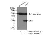 ASF/SF2 Antibody in Immunoprecipitation (IP)