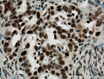 ASF/SF2 Antibody in Immunohistochemistry (Paraffin) (IHC (P))