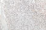 ASF/SF2 Antibody in Immunohistochemistry (Paraffin) (IHC (P))