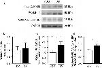 CaMKII delta Antibody in Western Blot (WB)