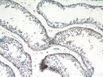 RASGAP Antibody in Immunohistochemistry (Paraffin) (IHC (P))