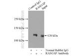 RASGAP Antibody in Immunoprecipitation (IP)