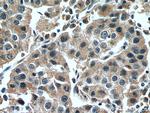 NFE2L1 Antibody in Immunohistochemistry (Paraffin) (IHC (P))