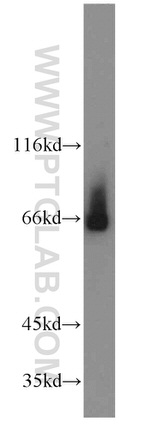 NFE2L1 Antibody in Western Blot (WB)