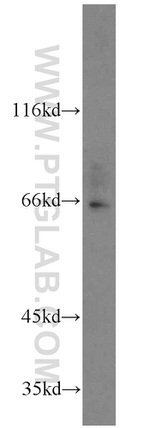 NFE2L1 Antibody in Western Blot (WB)