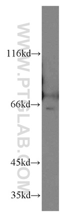 NFE2L1 Antibody in Western Blot (WB)