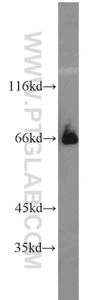 NFE2L1 Antibody in Western Blot (WB)