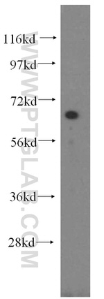 NFE2L1 Antibody in Western Blot (WB)