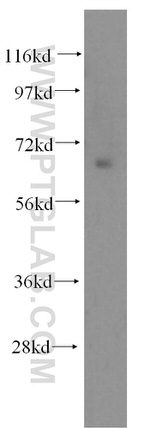 NFE2L1 Antibody in Western Blot (WB)