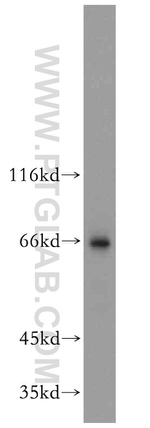 NFE2L1 Antibody in Western Blot (WB)