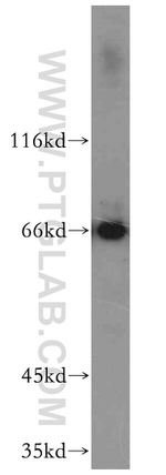 NFE2L1 Antibody in Western Blot (WB)