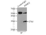 PSME2 Antibody in Immunoprecipitation (IP)