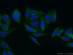 CLASP2 Antibody in Immunocytochemistry (ICC/IF)