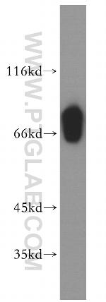 SLC27A3 Antibody in Western Blot (WB)