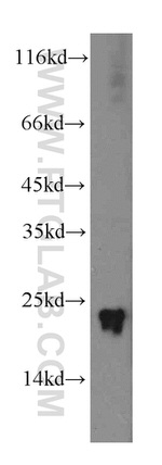 GCAP1 Antibody in Western Blot (WB)