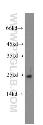 GCAP1 Antibody in Western Blot (WB)