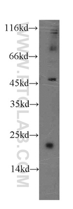 GCAP1 Antibody in Western Blot (WB)