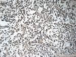 GAGE7 Antibody in Immunohistochemistry (Paraffin) (IHC (P))