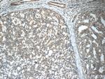 GAGE7 Antibody in Immunohistochemistry (Paraffin) (IHC (P))