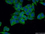 IMPDH2 Antibody in Immunocytochemistry (ICC/IF)