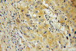 IMPDH2 Antibody in Immunohistochemistry (Paraffin) (IHC (P))