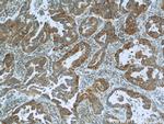 IMPDH2 Antibody in Immunohistochemistry (Paraffin) (IHC (P))