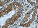 IMPDH2 Antibody in Immunohistochemistry (Paraffin) (IHC (P))