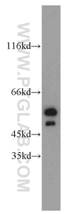 IMPDH2 Antibody in Western Blot (WB)