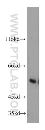 IMPDH2 Antibody in Western Blot (WB)