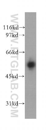 IMPDH2 Antibody in Western Blot (WB)