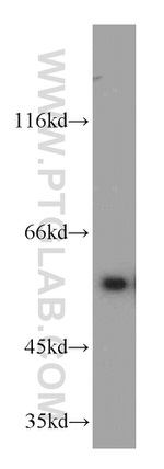 IMPDH2 Antibody in Western Blot (WB)