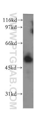 IMPDH2 Antibody in Western Blot (WB)