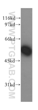 IMPDH2 Antibody in Western Blot (WB)