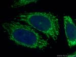 PDK4 Antibody in Immunocytochemistry (ICC/IF)