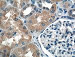 PDK4 Antibody in Immunohistochemistry (Paraffin) (IHC (P))