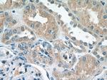 PDK4 Antibody in Immunohistochemistry (Paraffin) (IHC (P))