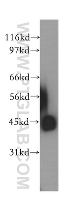 PDK4 Antibody in Western Blot (WB)