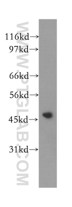 PDK4 Antibody in Western Blot (WB)