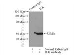 ILK Antibody in Immunoprecipitation (IP)